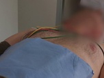 Replay Appels d'urgence - Samu de Toulouse : Les urgentistes au féminin en 1ère ligne