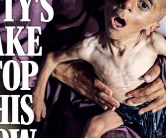 Replay Dans la presse - Une famine de masse se propage à Gaza