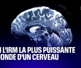 Replay L'image du jour - Voici l'IRM la plus précise au monde d'un cerveau (et elle est française)